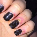 Manicure turns to nightmare for Rotorua teen